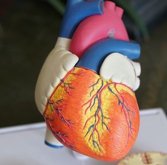توقف القلب والأوعية الدموية Arrêts cardiovasculaires