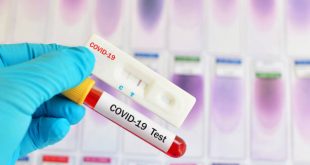 كورونا | كل ما يجب معرفته حول التحاليل الطبية للكشف عن الإصابة بفيروس كوفيد- 19.