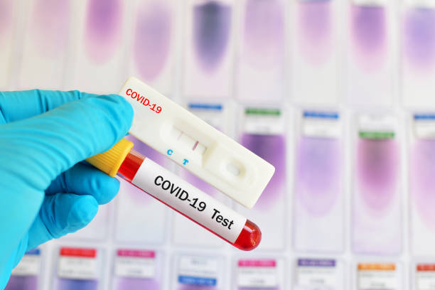 كورونا | كل ما يجب معرفته حول التحاليل الطبية للكشف عن الإصابة بفيروس كوفيد- 19.